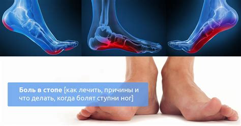 Эффективные методы лечения боли в суставах ступни